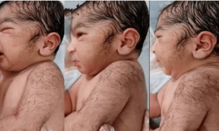 Baby Born With Hairs