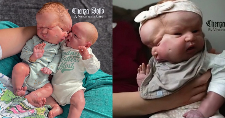 Newborn With 2 Faces